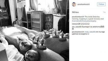 El nadador bielorruso Pavel Sankovich publicó en Instagram una foto de sus piernas cubiertas de ventosas.<div> </div>