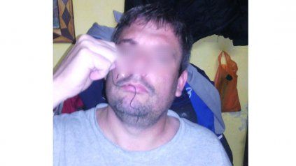 Advertencias. Amenazan con coserse la boca en la protesta. 