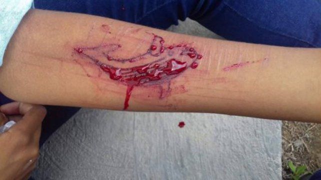 <b> Similar a la ballena azul</b>. El mecanismo de instigación llevaba al peor final.